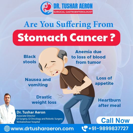 Stomach Cancer treatment