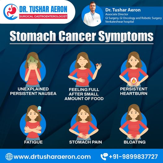 Stomach Cancer Treatment