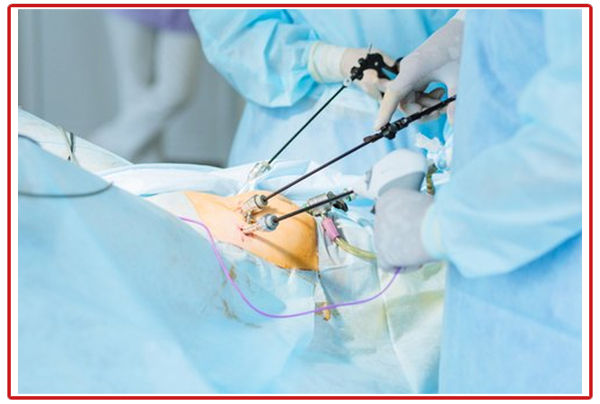 Best Cancer Surgeon in Delhi NCR – Why Patients Trust Dr. Tushar Aeron